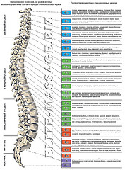 Заболевания позвоночника
